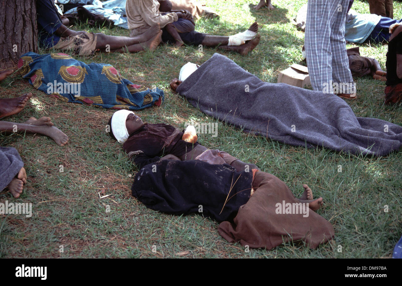 08 apr 1994 - Il Burundi e il Ruanda - Bambini con machete ferite alla testa e le mani di recuperare in ospedale da campo come Tutsi ruandesi rifugiati fuggono attraverso la frontiera con il Burundi in aprile 1994 come gli Hutu impegnato il genocidio in cento giorni di guerra civile. Il genocidio ruandese è stato il 1994 omicidi di massa di una stima che 800.000 persone nel piccolo Oriente nazione africana del Rwanda. Nel corso di circa Foto Stock