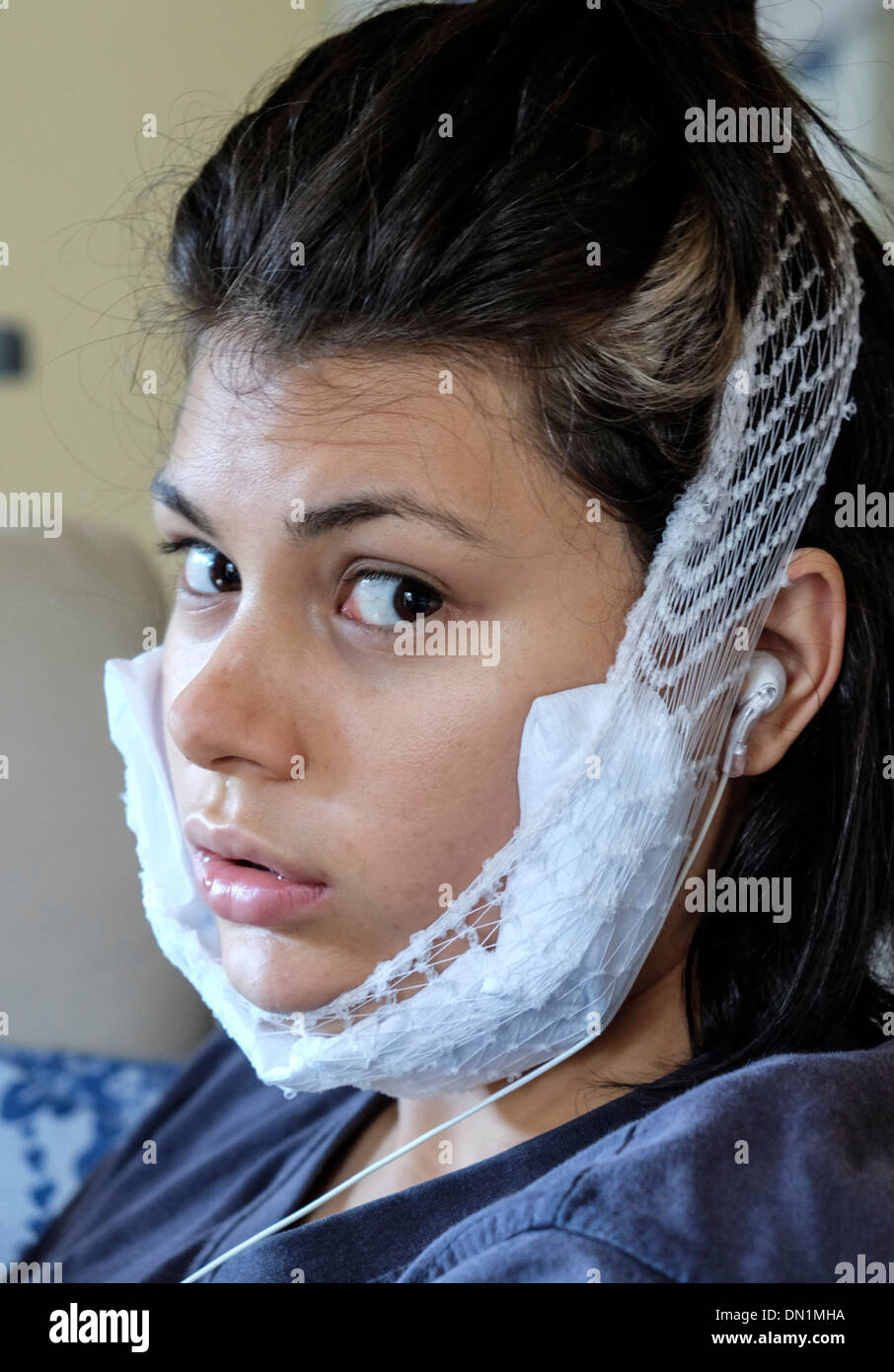 Adolescente recuperando dalla rimozione di saggezza denti usando un pacco freddo Foto Stock
