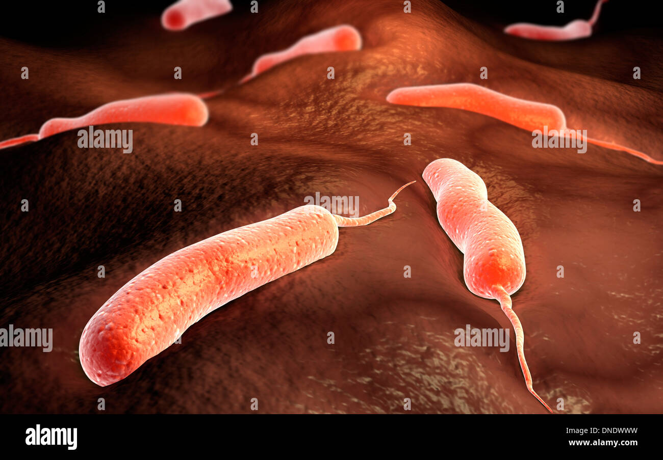 Immagine concettuale di vibrio cholerae causando il colera. Foto Stock