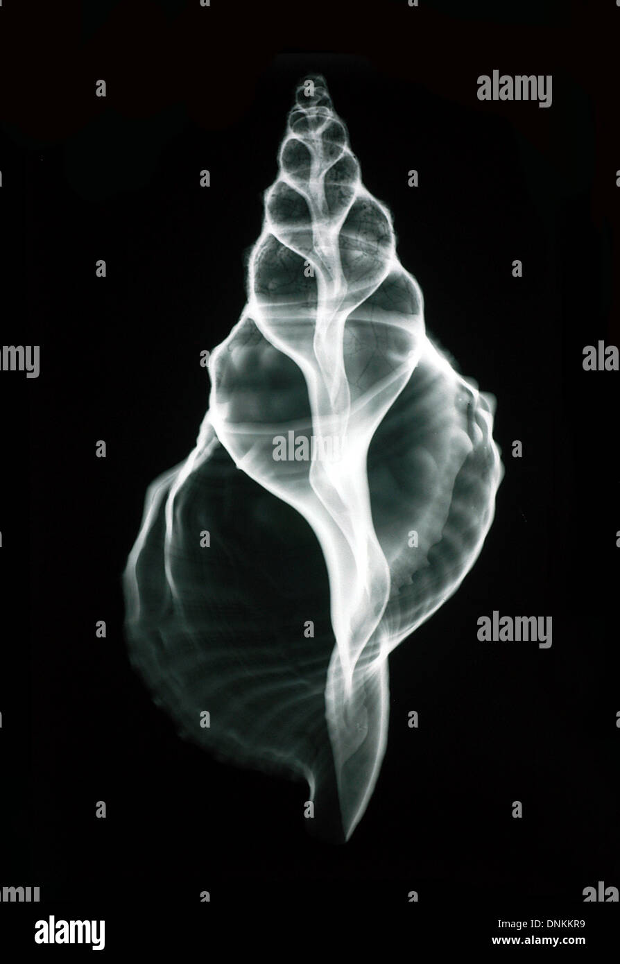 X-Ray di Gasteropoda Shell, Mollusca Foto Stock