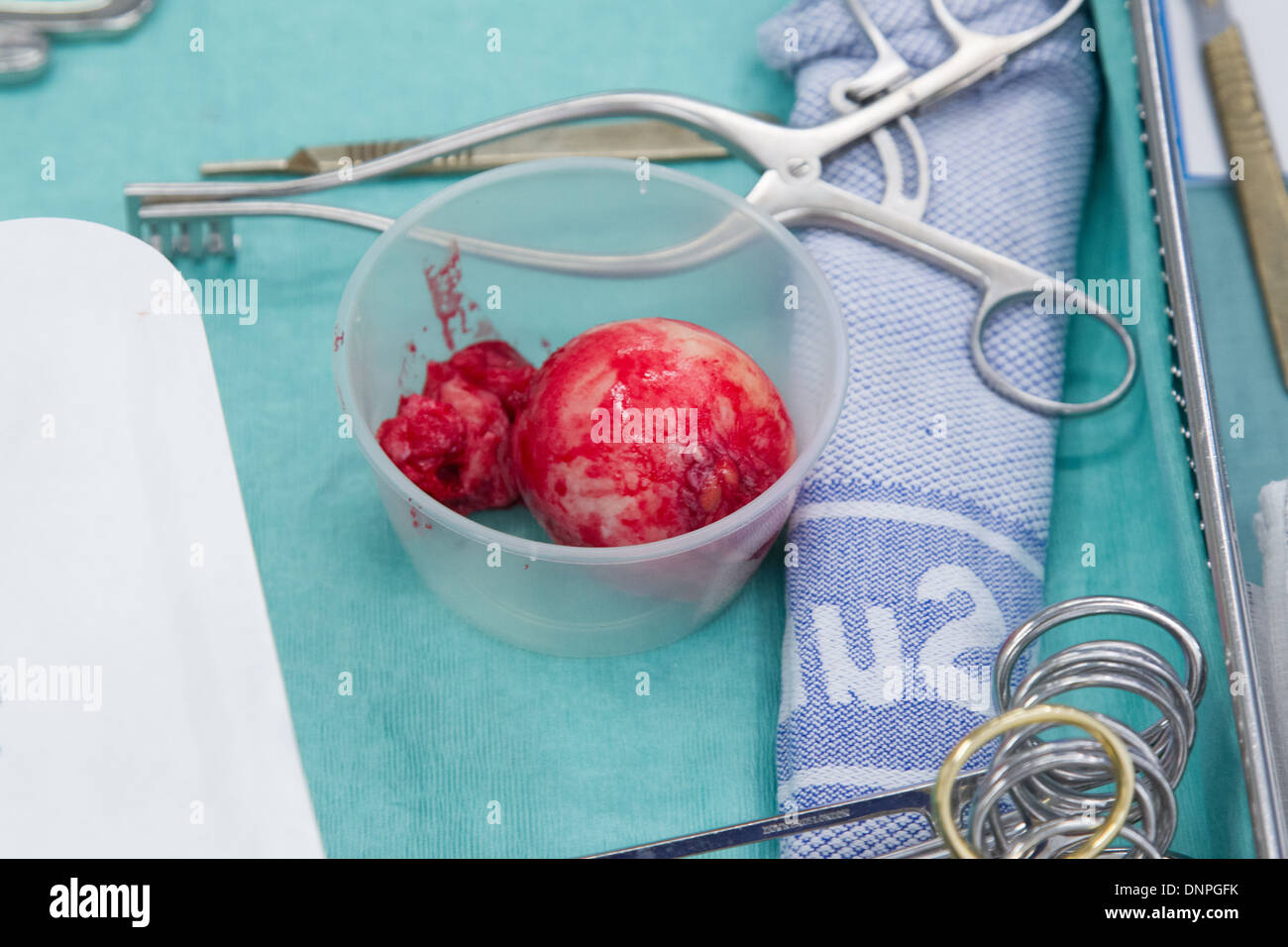 Operazione al ginocchio - teatro ospedaliero-personale sul luogo di lavoro-Strumenti per il funzionamento di apparecchiature ospedaliere Foto Stock