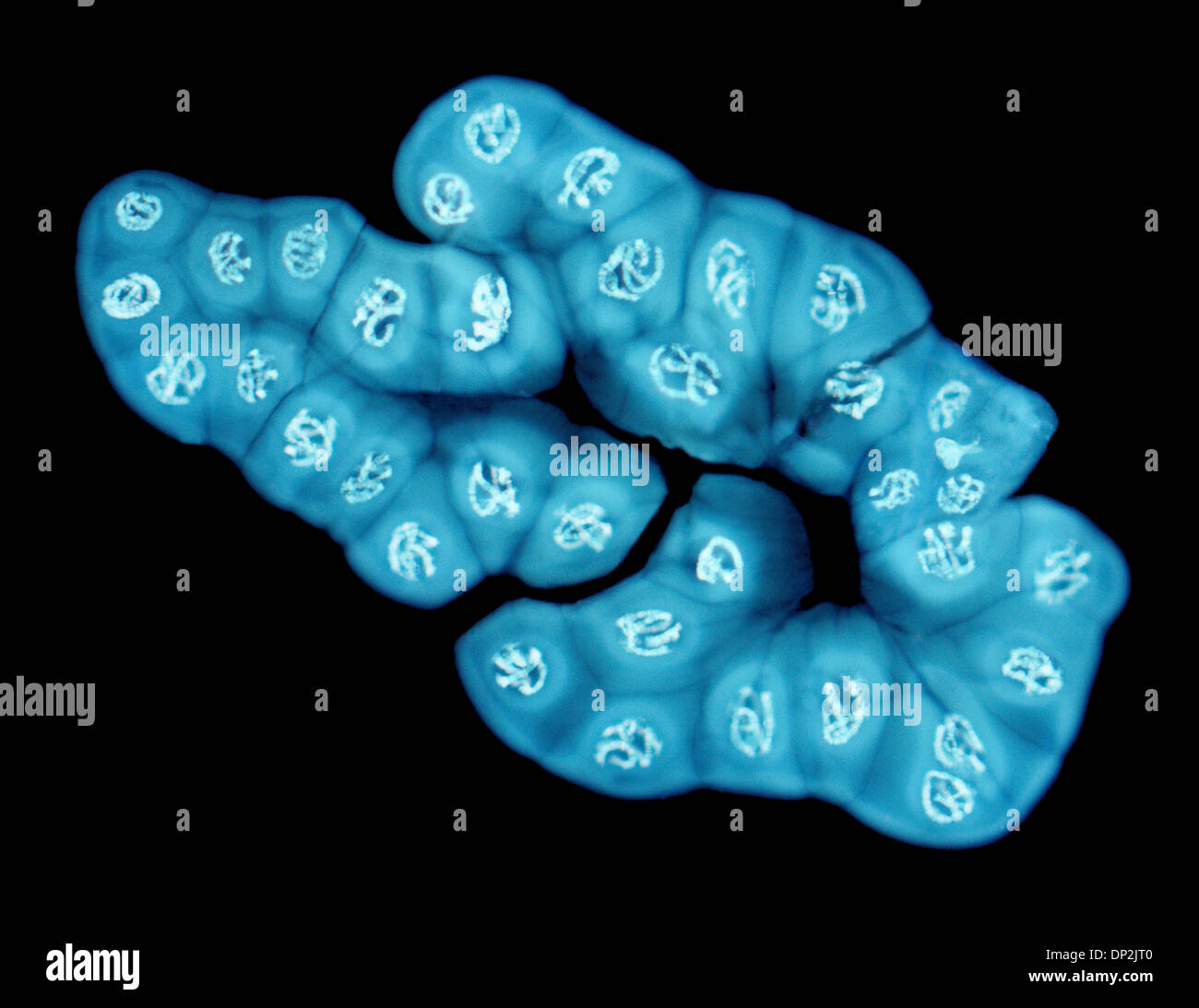 Cromosomi giganti, micrografia di luce Foto Stock