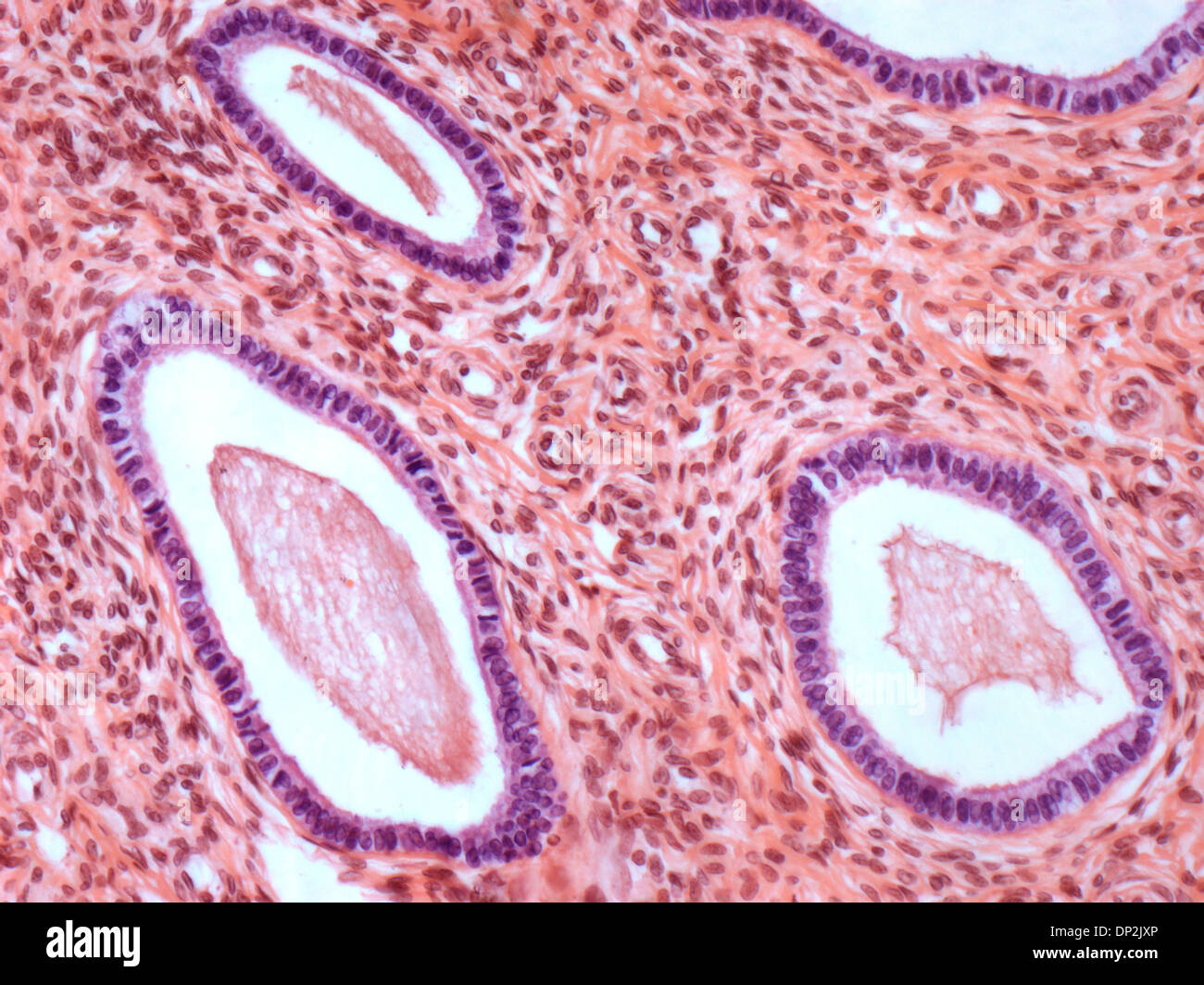 Muco cervicale immagini e fotografie stock ad alta risoluzione - Alamy