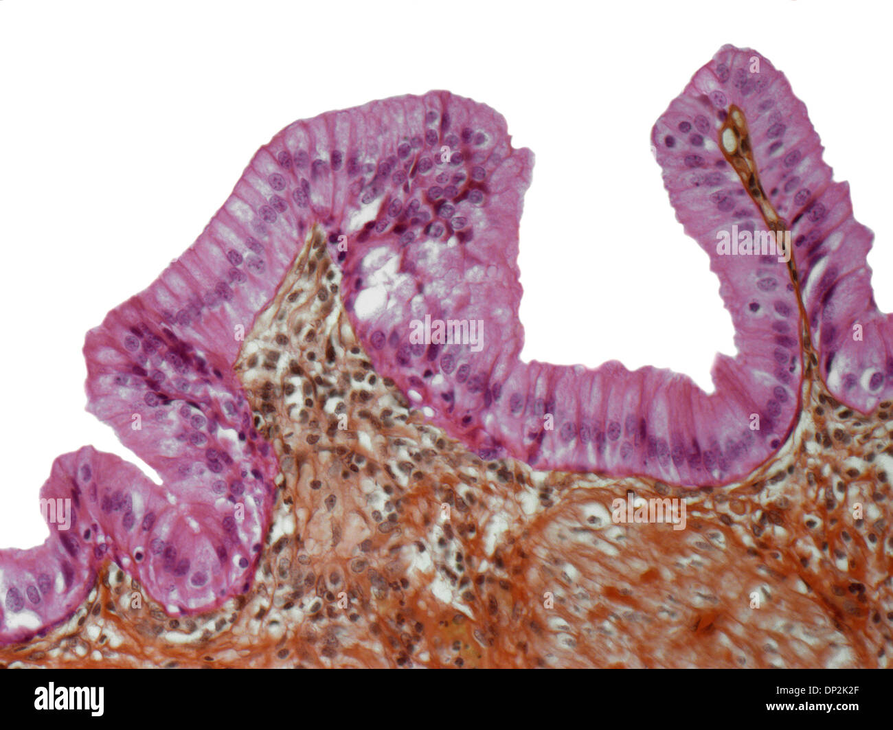 La cistifellea fodera, micrografia di luce Foto Stock