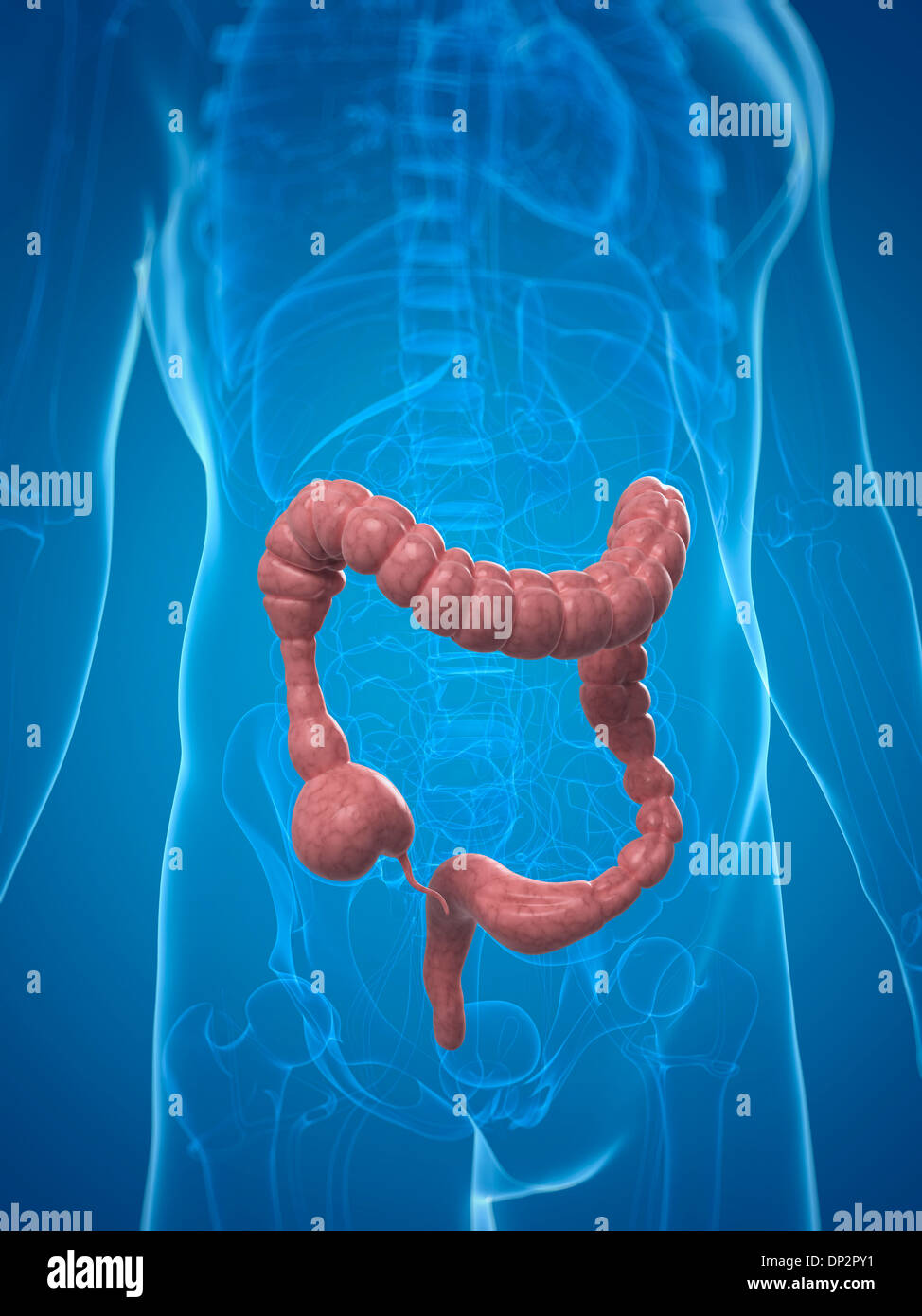 Gli spasmi del colon, artwork Foto Stock