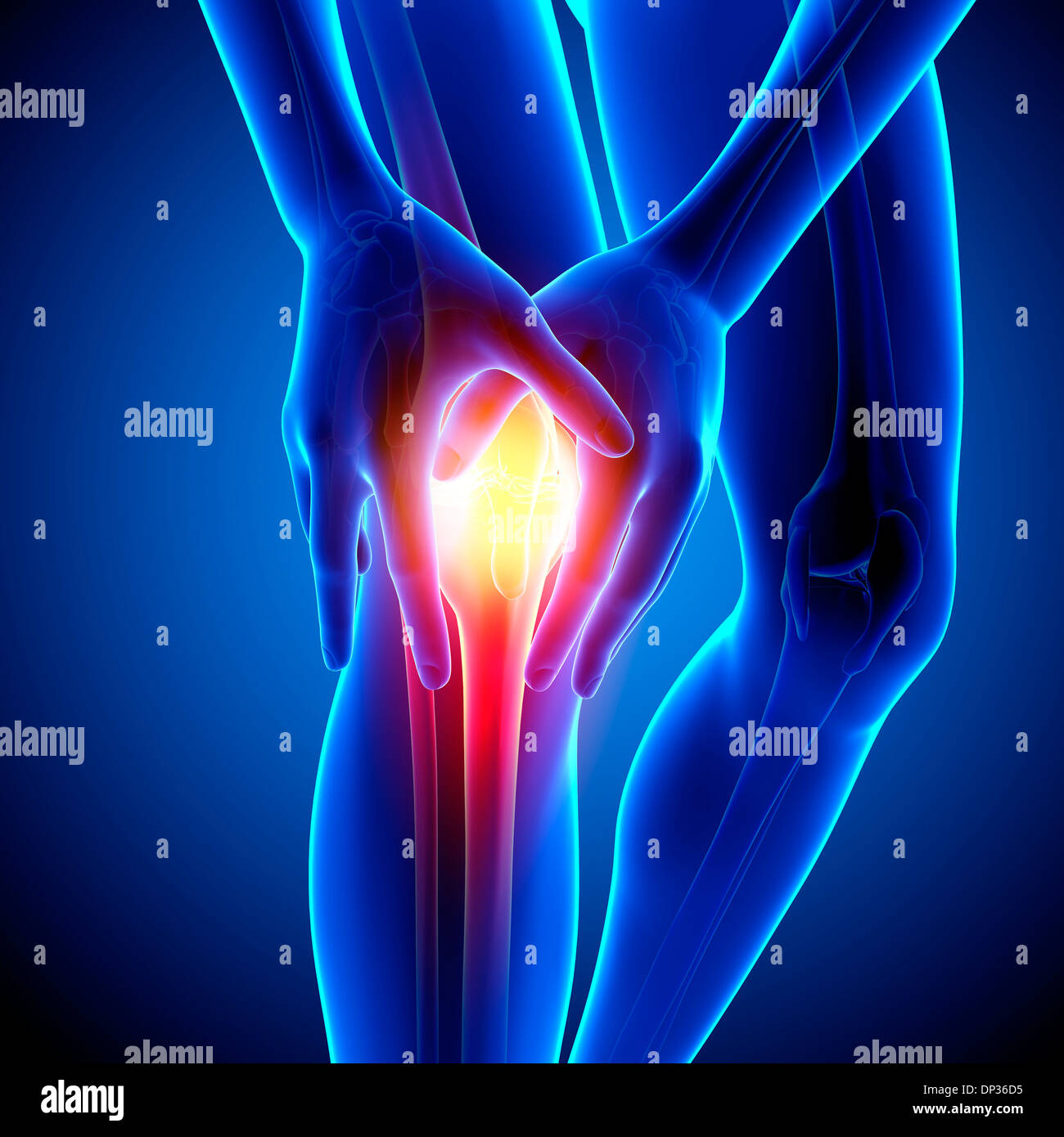 Il dolore al ginocchio, artwork Foto Stock