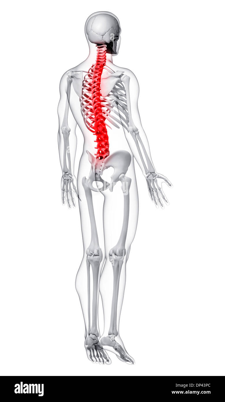 Il dolore della colonna vertebrale, artwork Foto Stock