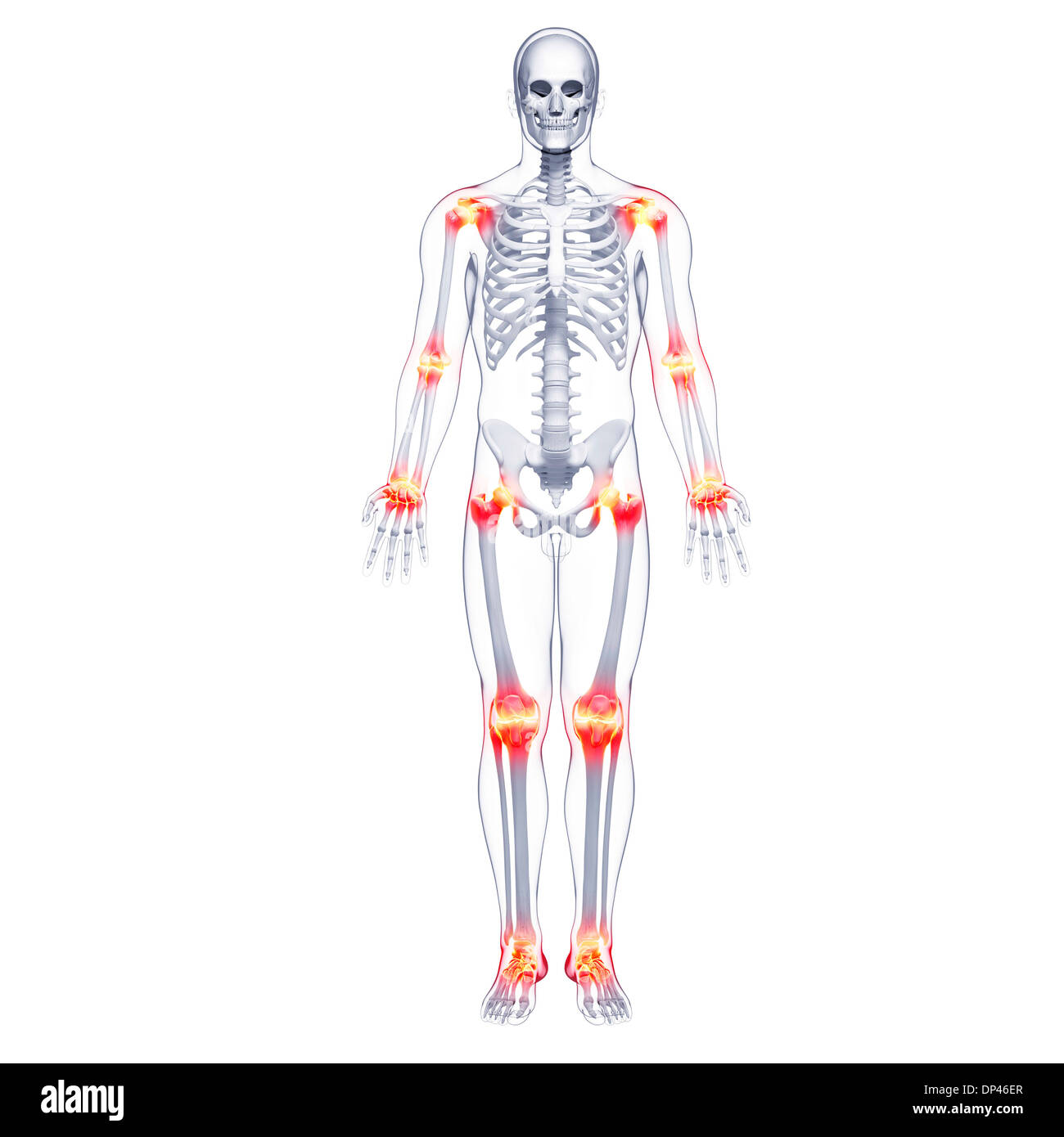 I dolori articolari, artwork Foto Stock