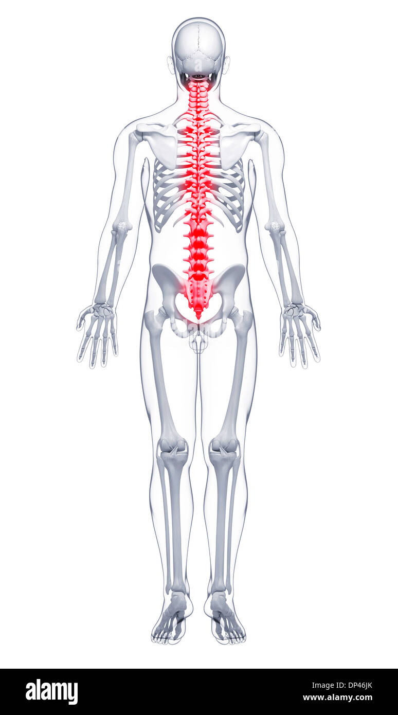 Il dolore della colonna vertebrale, artwork Foto Stock