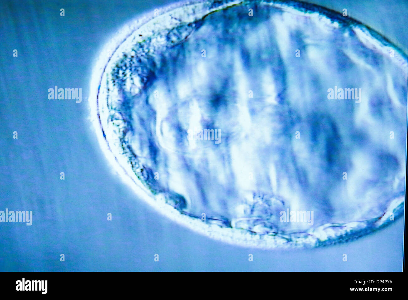 Blastocisti embrione, micrografia di luce Foto Stock