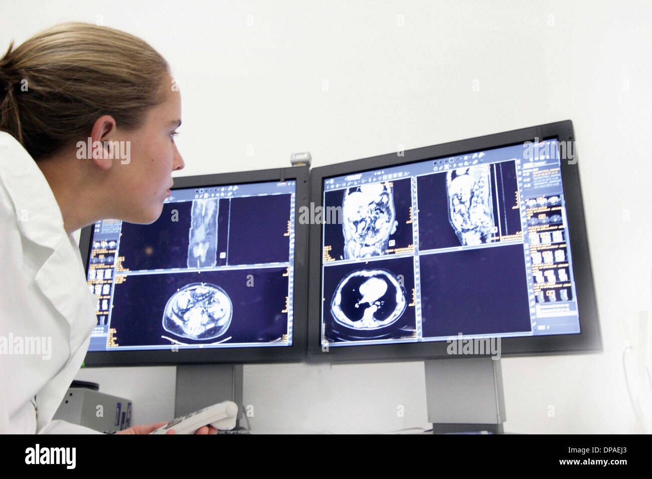 Medico donna esaminando le scansioni CT sul monitor del computer Foto Stock