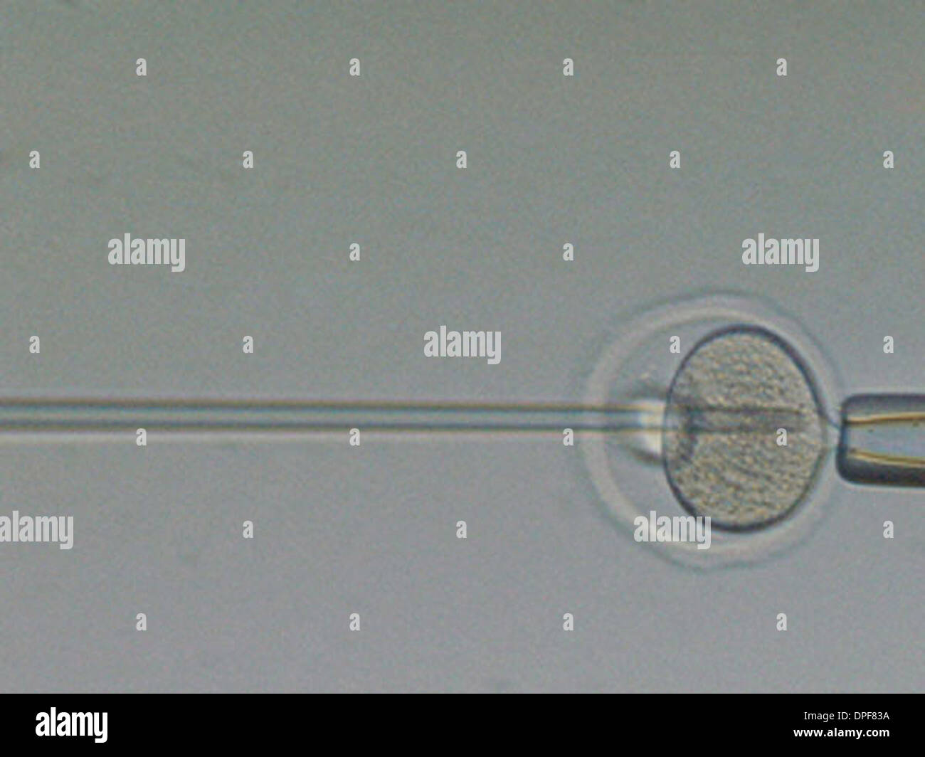 Immagine raffigurante la fecondazione in vitro di un uovo Foto Stock