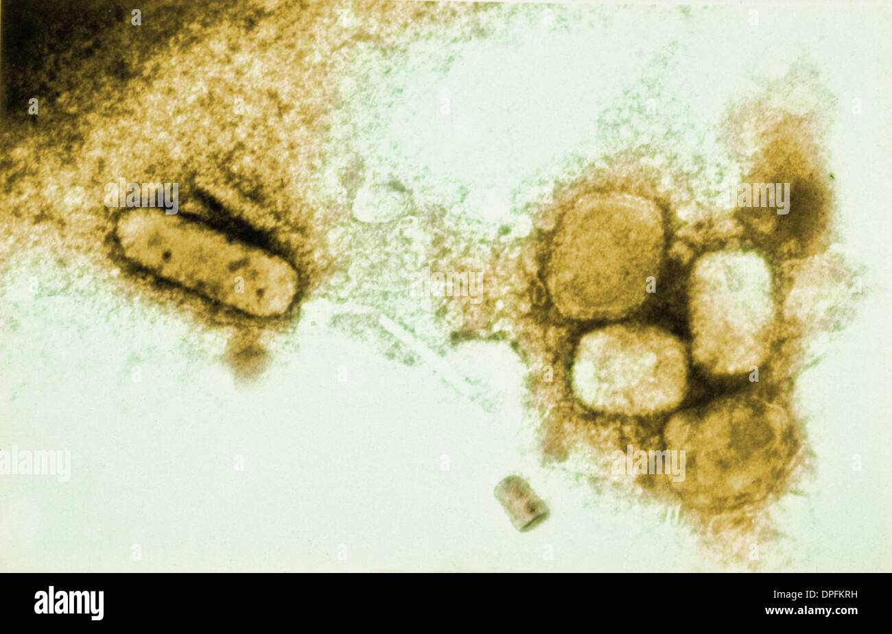 Smallpox variola virus immagini e fotografie stock ad alta risoluzione ...