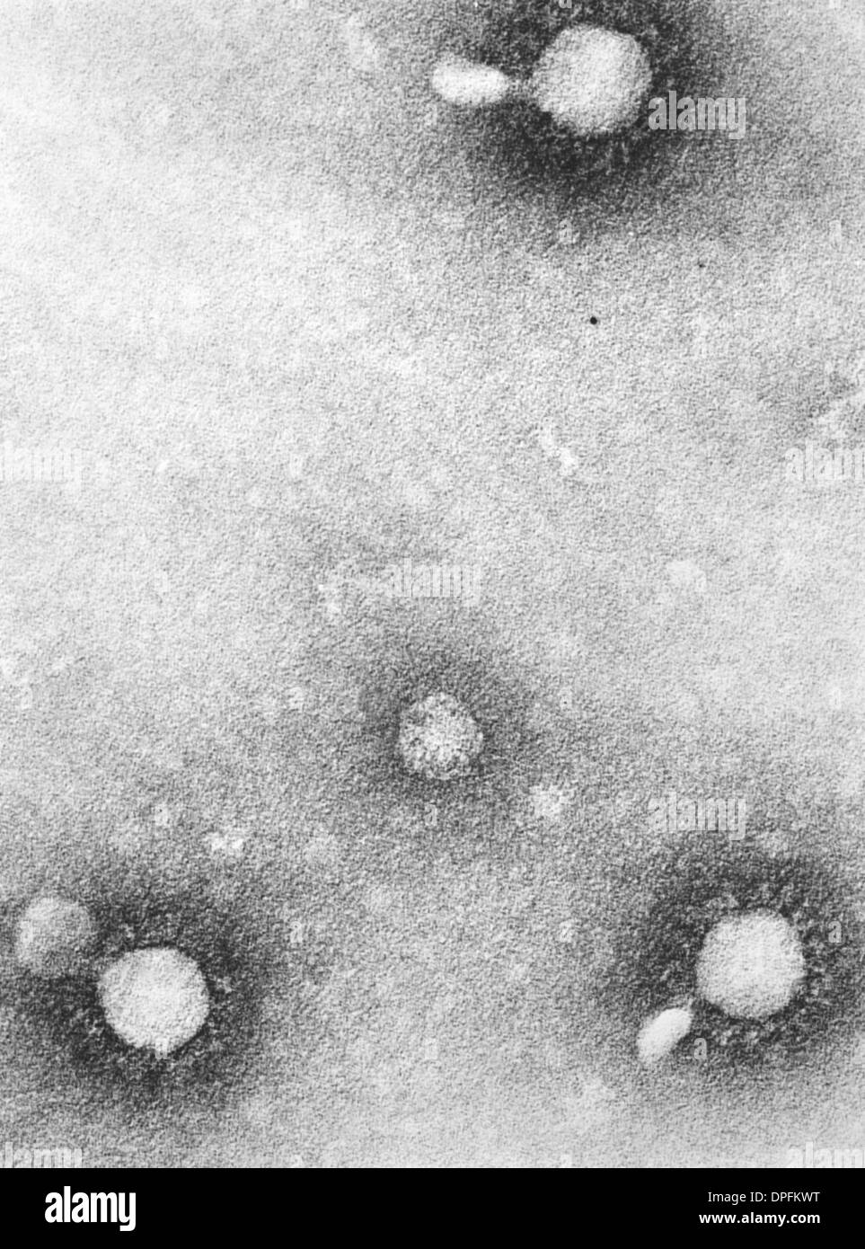 TEM dell'encefalomielite equina (VEE) virus Foto Stock