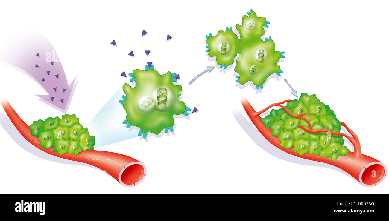 Cancro legato agli ormoni, illustrazione Foto Stock