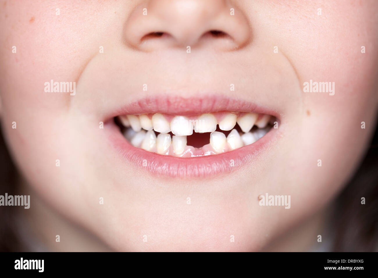 Carino bambina con lo spazio del dente sorriso Foto Stock
