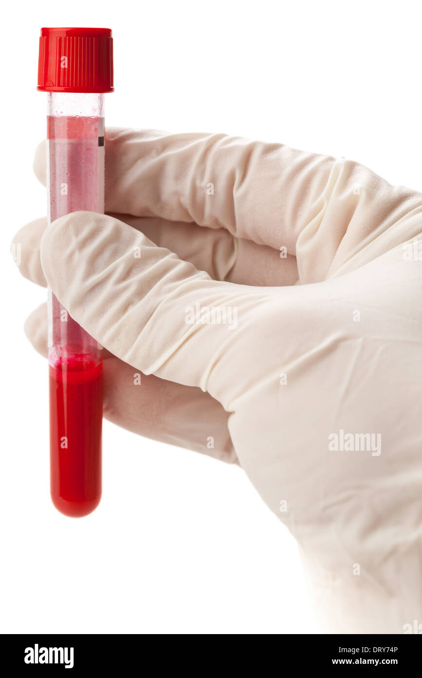 Mano con guanto in lattice azienda fiala di campione di sangue isolati su sfondo bianco Foto Stock