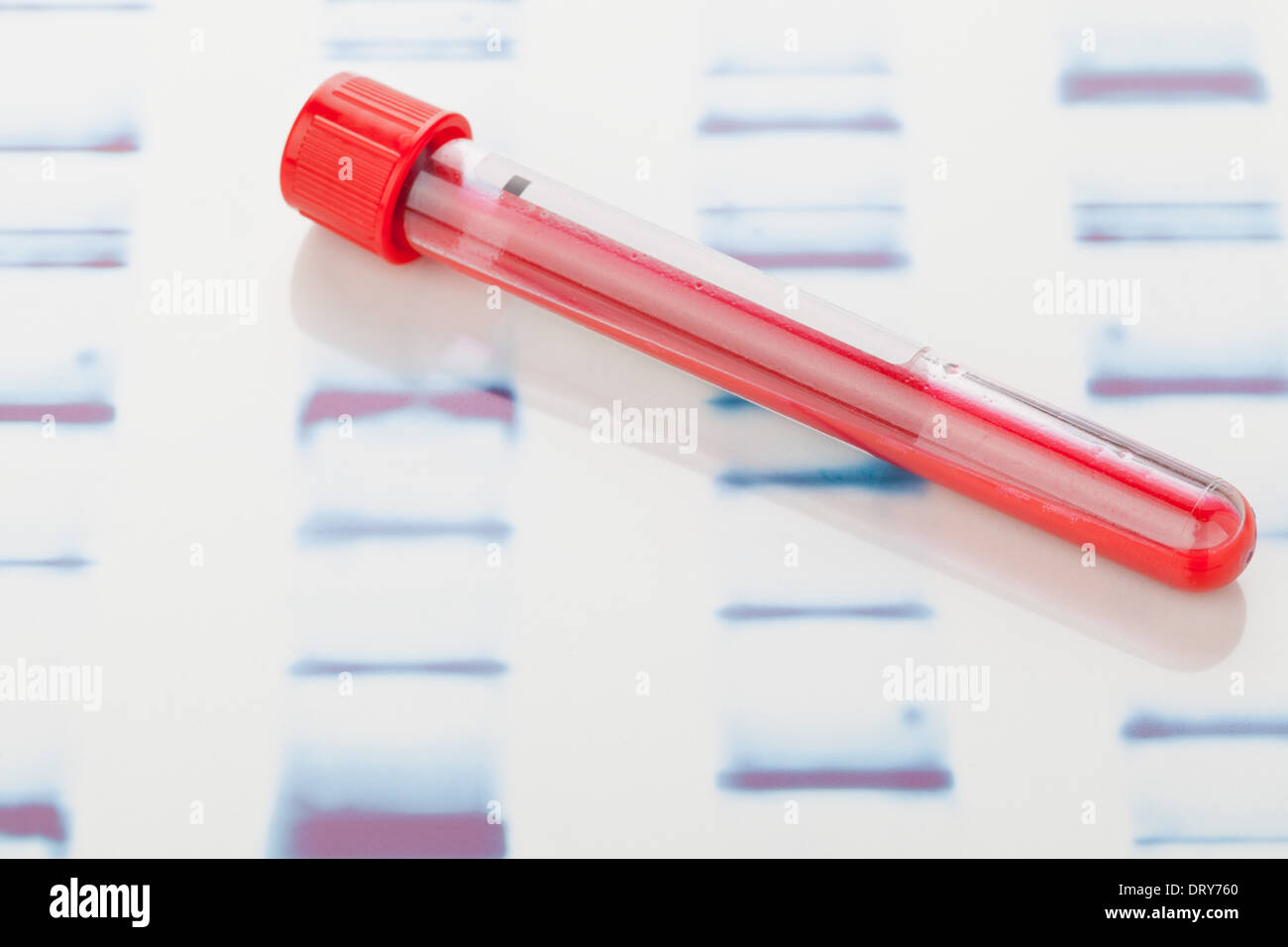Fiala di campione di sangue sul DNA bianco sullo sfondo di prova Foto Stock