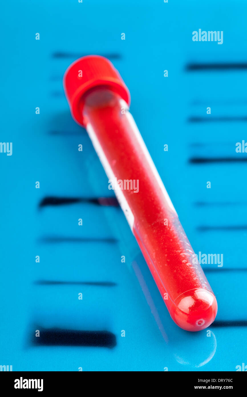 Fiala di campione di sangue sul DNA blu sullo sfondo di prova Foto Stock