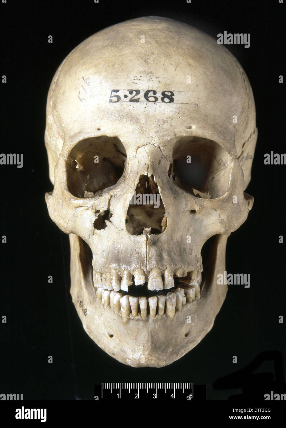 Homo sapiens cranio (Italia) Foto Stock