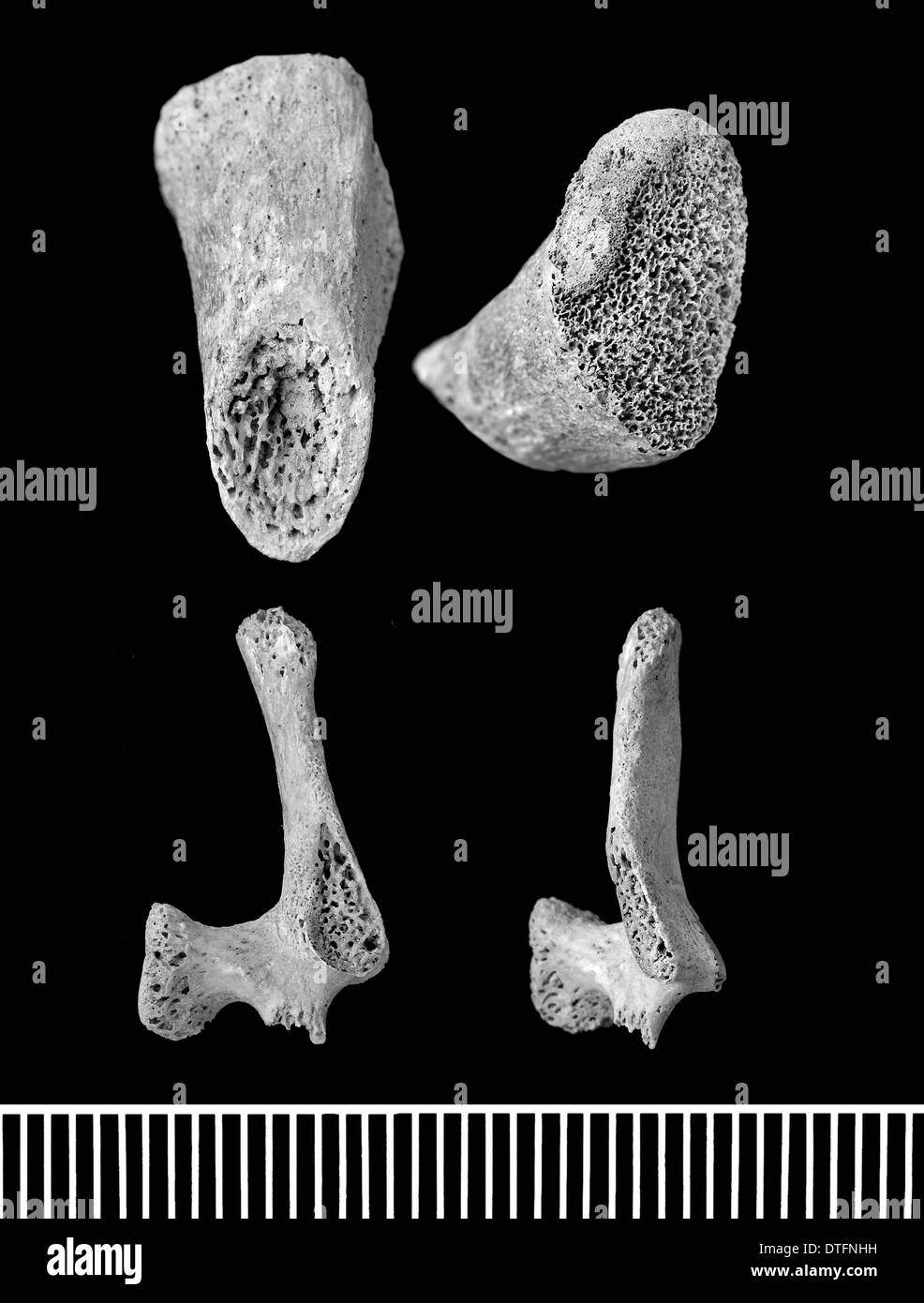 La parte umana di scheletro perinatale Foto Stock