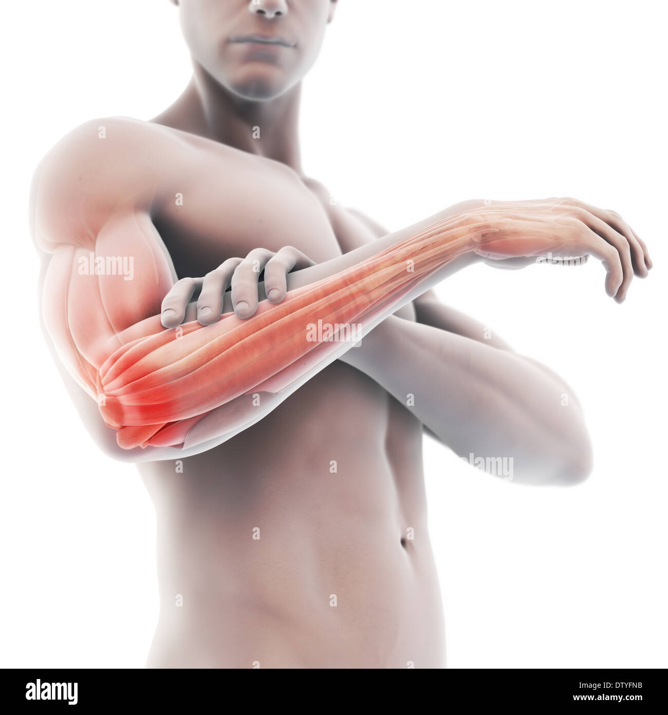 Gomito del tennista Foto Stock