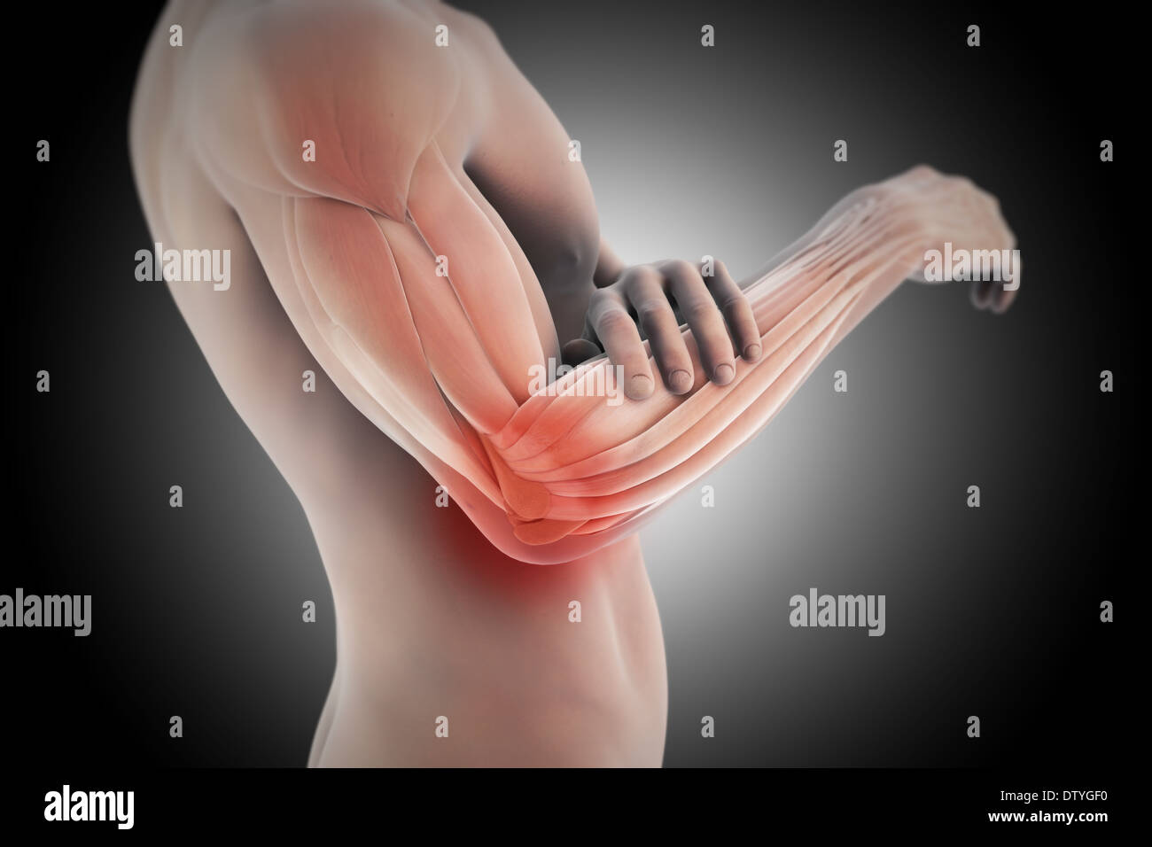 Gomito del tennista Foto Stock