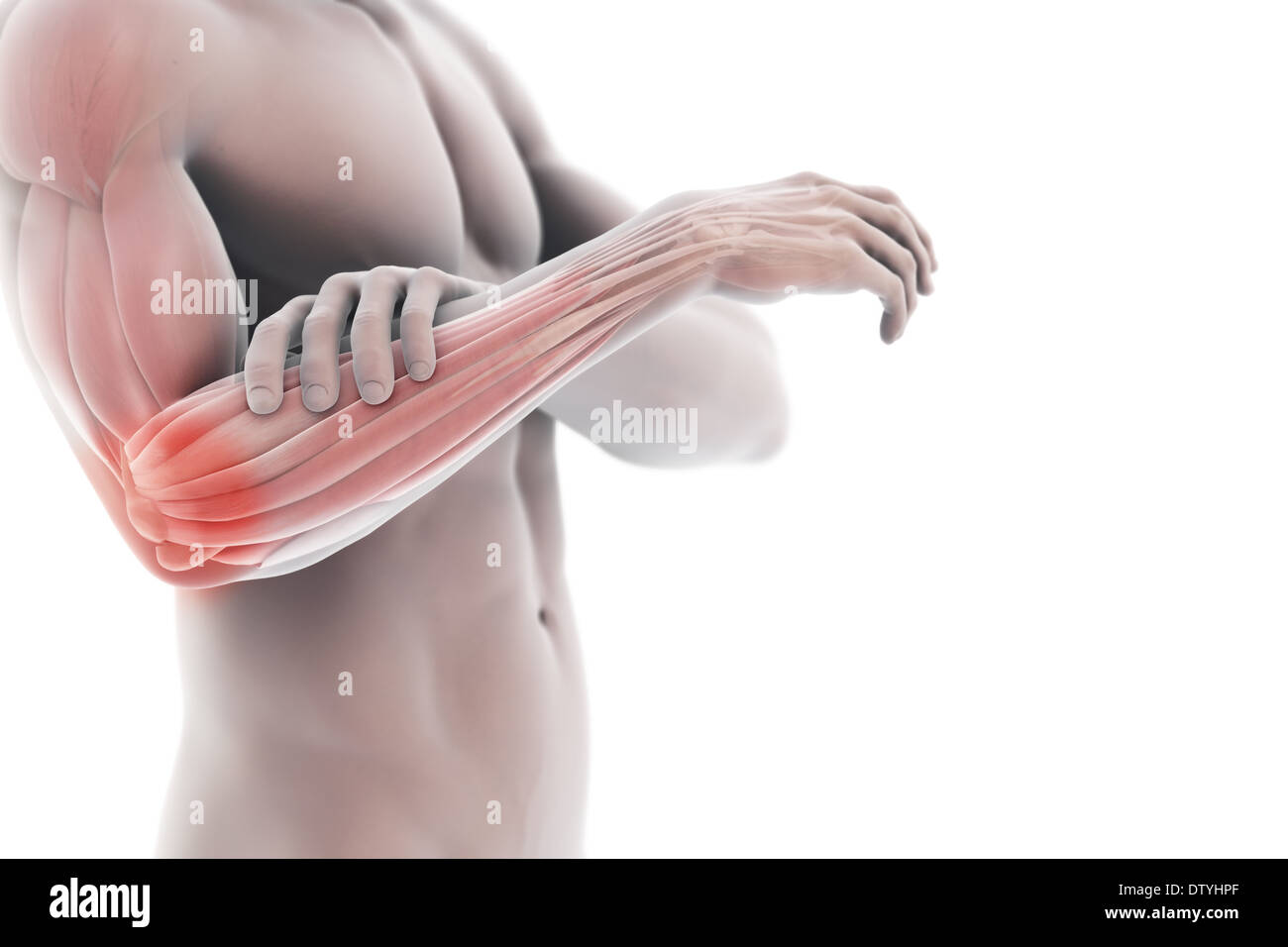 Gomito del tennista Foto Stock