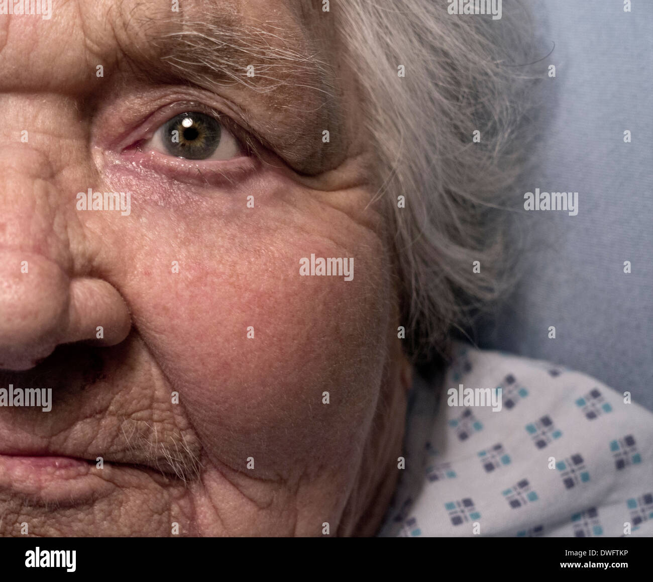 Signora anziana volto vulnerabile 100 anni vecchia signora da sola in ospedale letti di cura di salute senior demenza letto di cura a lungo termine Foto Stock