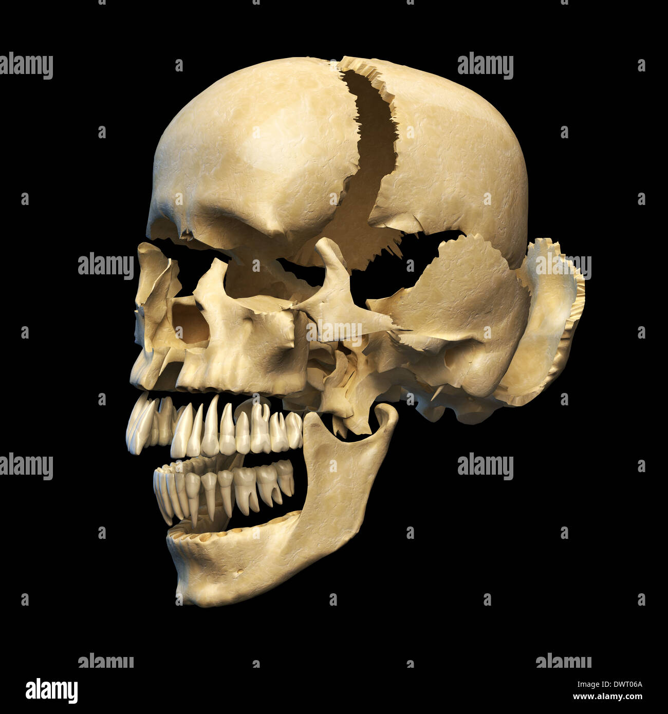 Cranio umano con parti esplose. In prospettiva, su sfondo nero. Percorso di clipping incluso. Foto Stock