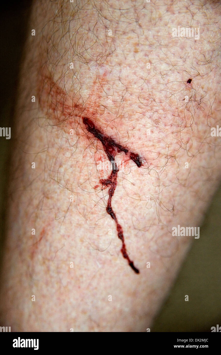 Graffio di sangue sulla gamba Foto Stock