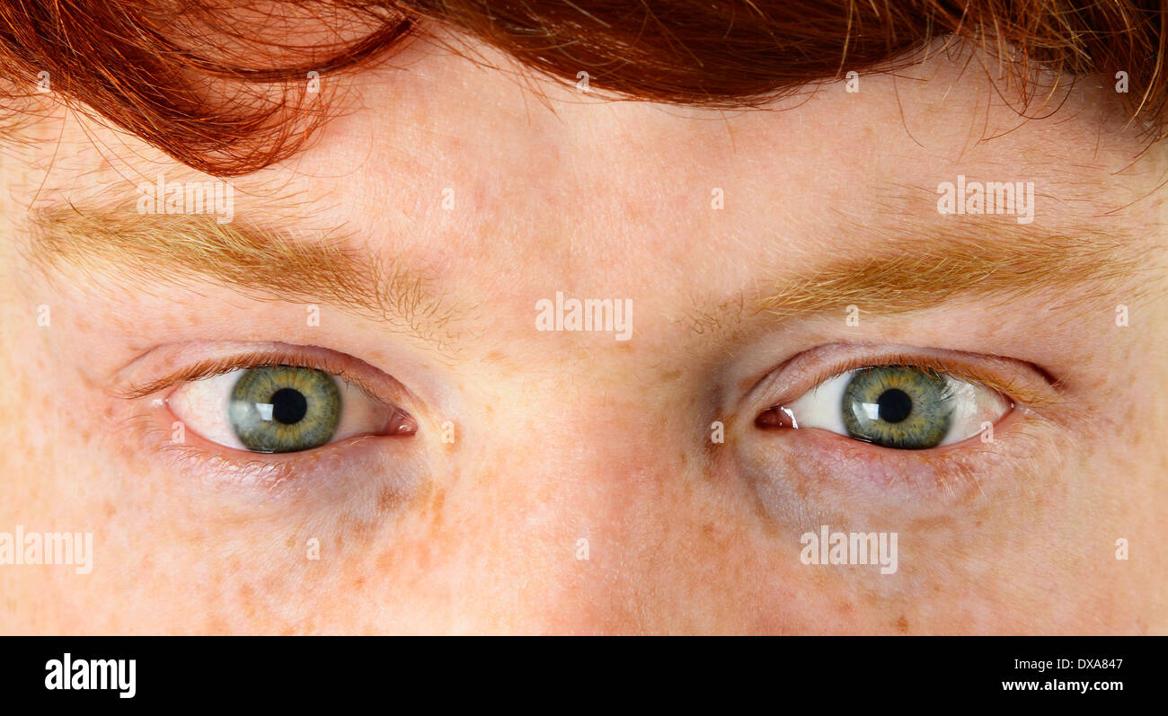 Giovane uomo con i capelli rossi, lentiggini e occhi verdi Foto Stock