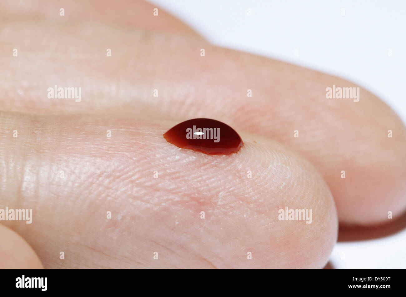 (Sintetico) goccia di sangue su un dito maschio Foto Stock