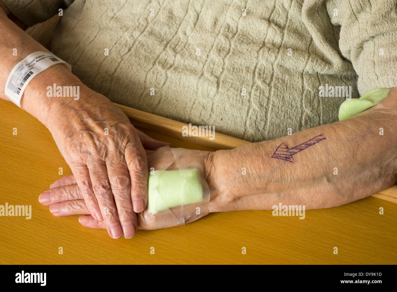 Signora anziana nei suoi anni novanta essendo preparato per anestetico generale. Foto Stock