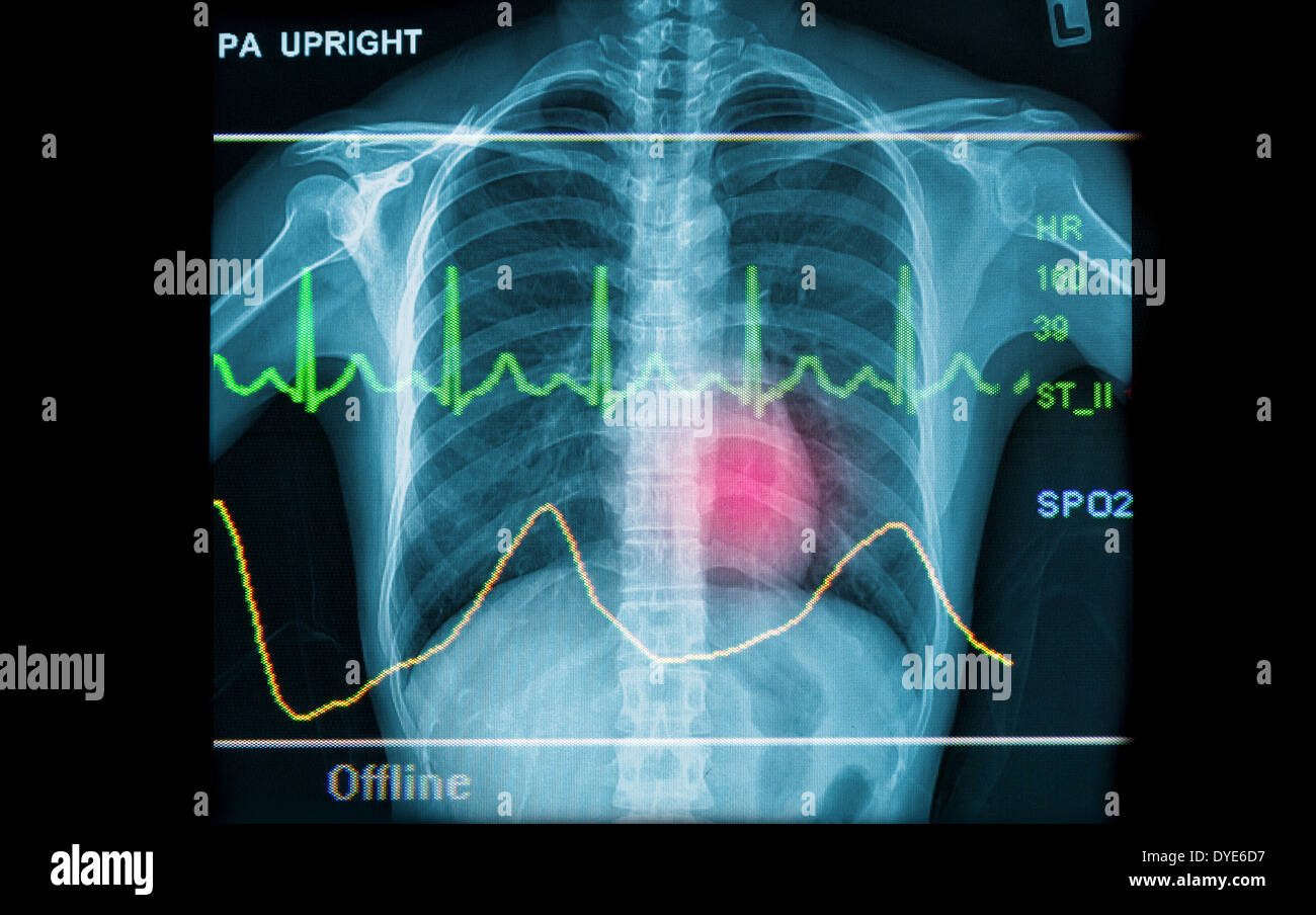 Abstract medici e sanitari che mostra gli sfondi delle immagini a raggi x e la linea ECG Foto Stock