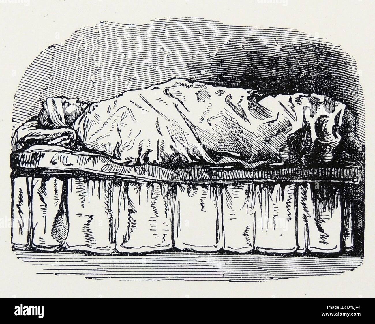 Pacco bagnato: paziente avvolto in freddo, foglio umido per un massimo di 60 minuti, il paziente ha poi preso un tuffo a freddo. Utilizzato per molte condizioni di stipsi per i reumatismi. Dal ''idropatia pratici'', Londra, 1863. Foto Stock