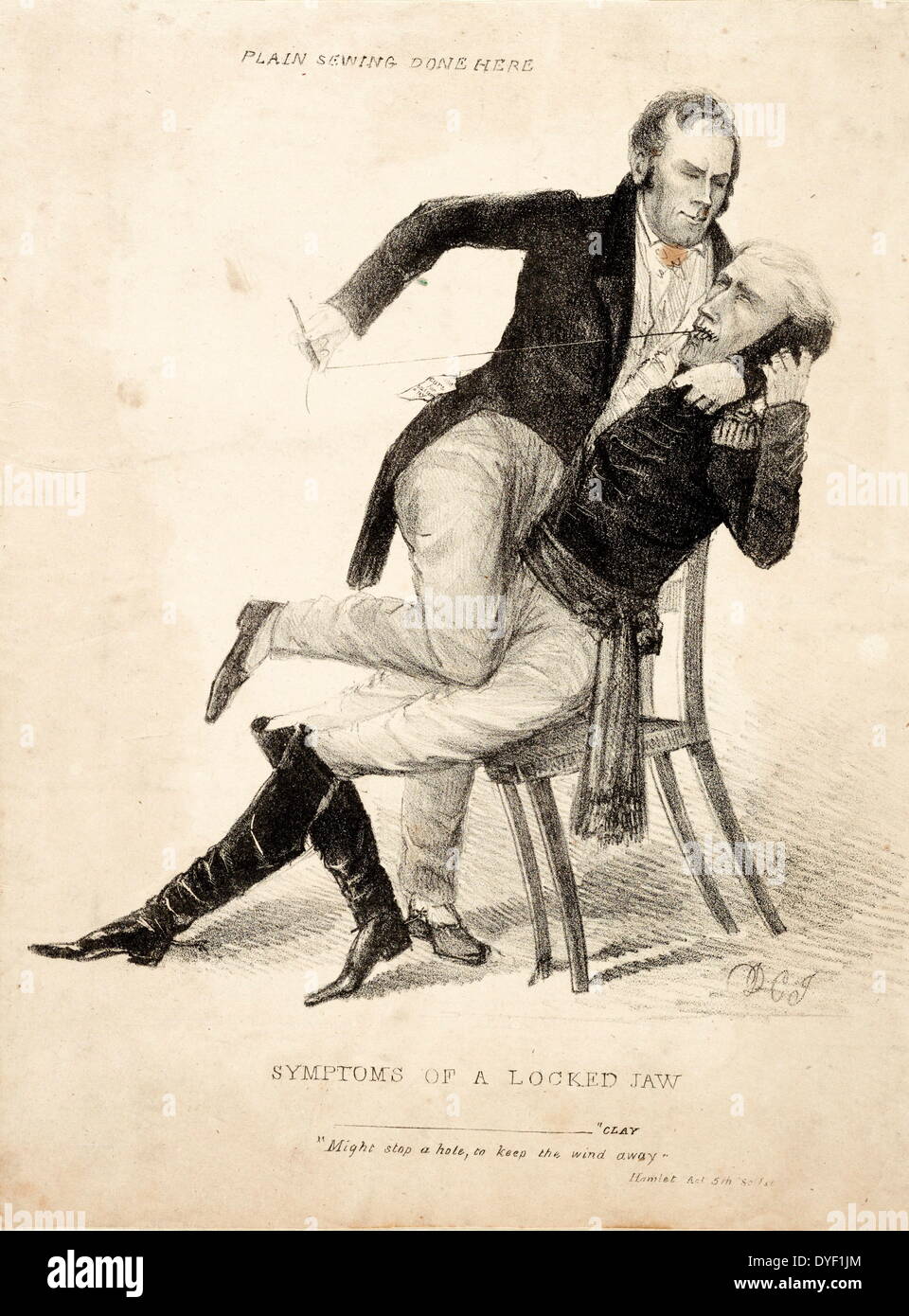 I sintomi di una ganascia bloccato. Cucitura semplice fatto qui. da David Claypoole Johnston. Circa 1834. Litografia di stampare su carta intessuta. Cartoon politico che rappresenta il feudo tra Henry Clay e Presidente Andrew Jackson tra 1832-1836. Durante la quale hanno combattuto sul futuro della Banca degli Stati Uniti. L'immagine mostra argilla Jackson di ritegno mentre la cucitura con forza la sua bocca. Dietro di loro sono le parole 'cucitura semplice fatto qui'. Foto Stock
