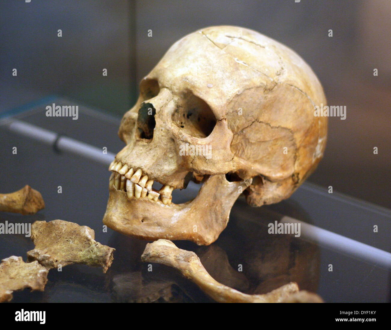 Cranio ricostruito dai resti di un uomo siriano dell'età di circa 45 anni. Fu ricostruita dai resti trovati in una bara di piombo camicia. Foto Stock
