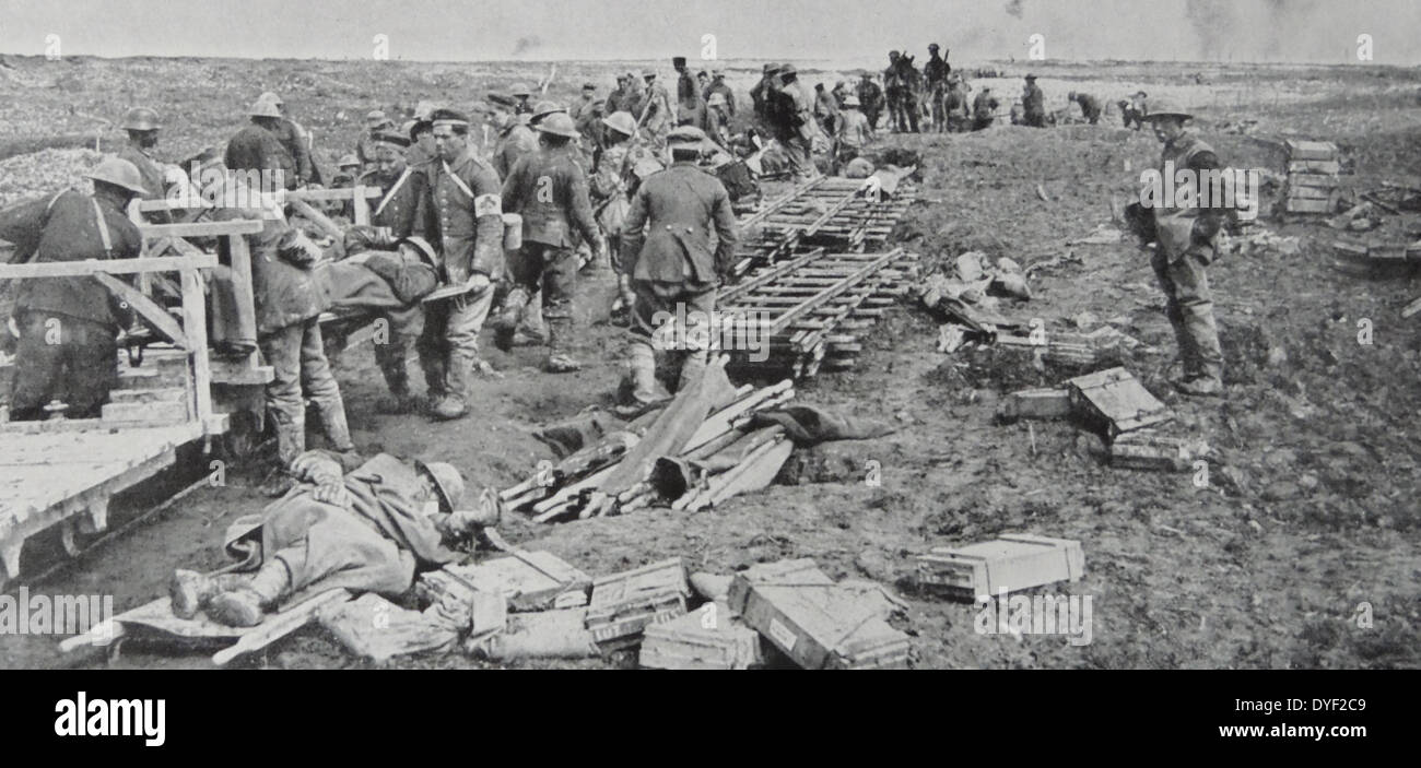 Soldati canadesi al frontline durante la guerra mondiale una evacuazione feriti vittime. 1917 Foto Stock