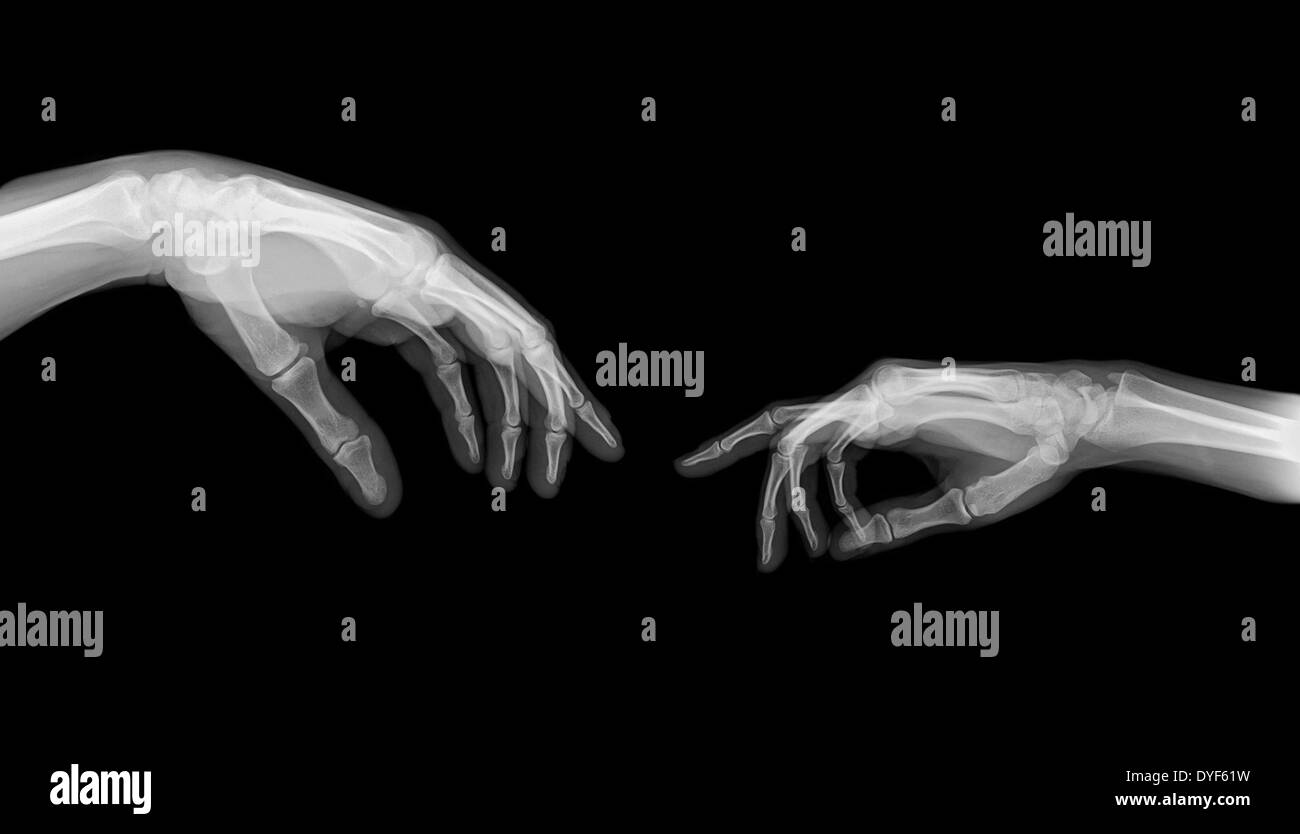 La creazione di Adamo di Michelangelo due mani sotto x-ray Foto Stock