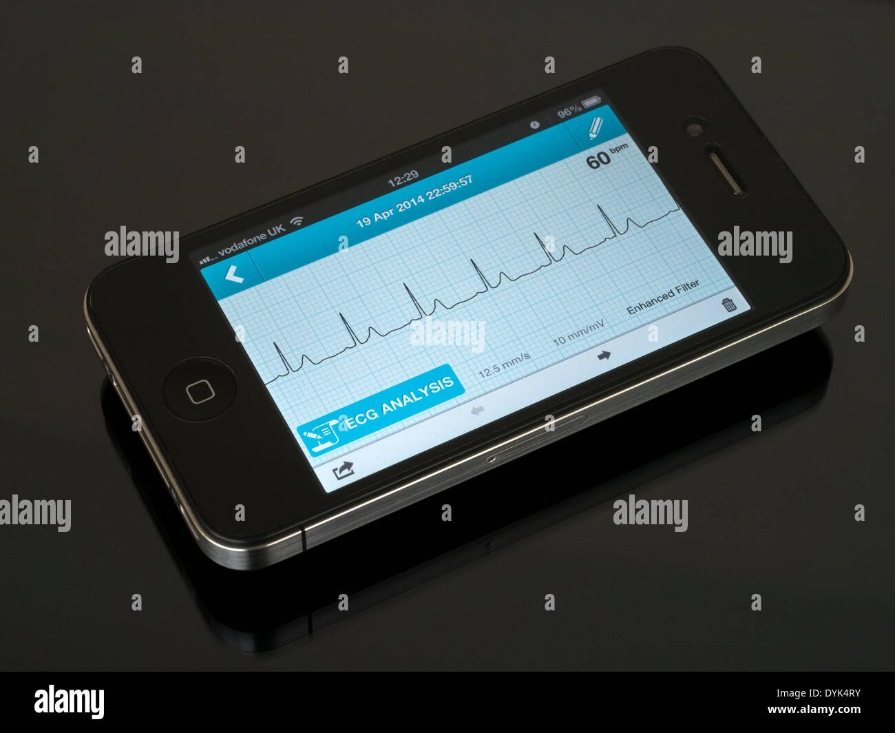 ECG portatile EKG Cardiofrequenzimetro App in esecuzione su iPhone 4 che  mostra sinusale normale ritmo cardiaco traccia Foto stock - Alamy