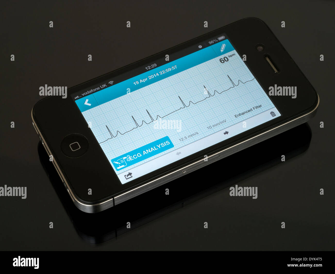 ECG portatile EKG Cardiofrequenzimetro App in esecuzione su iPhone 4 che mostra sinusale normale ritmo cardiaco tracciato con un battito ectopico Foto Stock