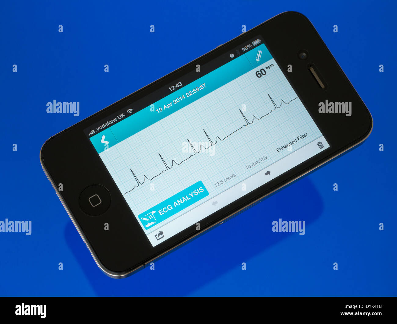 ECG portatile EKG Cardiofrequenzimetro App in esecuzione su iPhone 4 che mostra sinusale normale ritmo cardiaco tracciato con un battito ectopico. Foto Stock