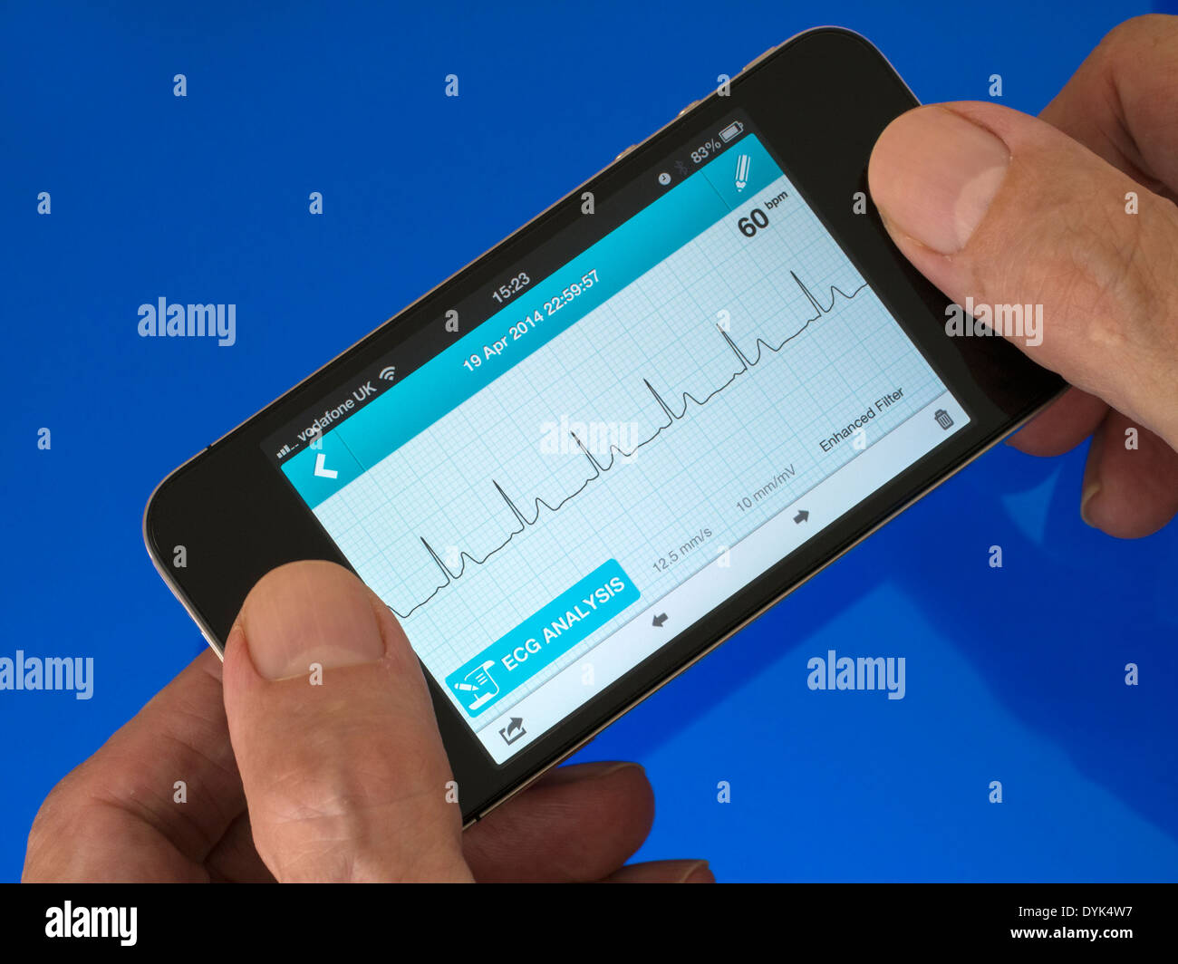 Utente azienda ECG portatile EKG Cardiofrequenzimetro App in esecuzione su iPhone 4 con la traccia che mostra sinusale normale ritmo cardiaco traccia. Foto Stock