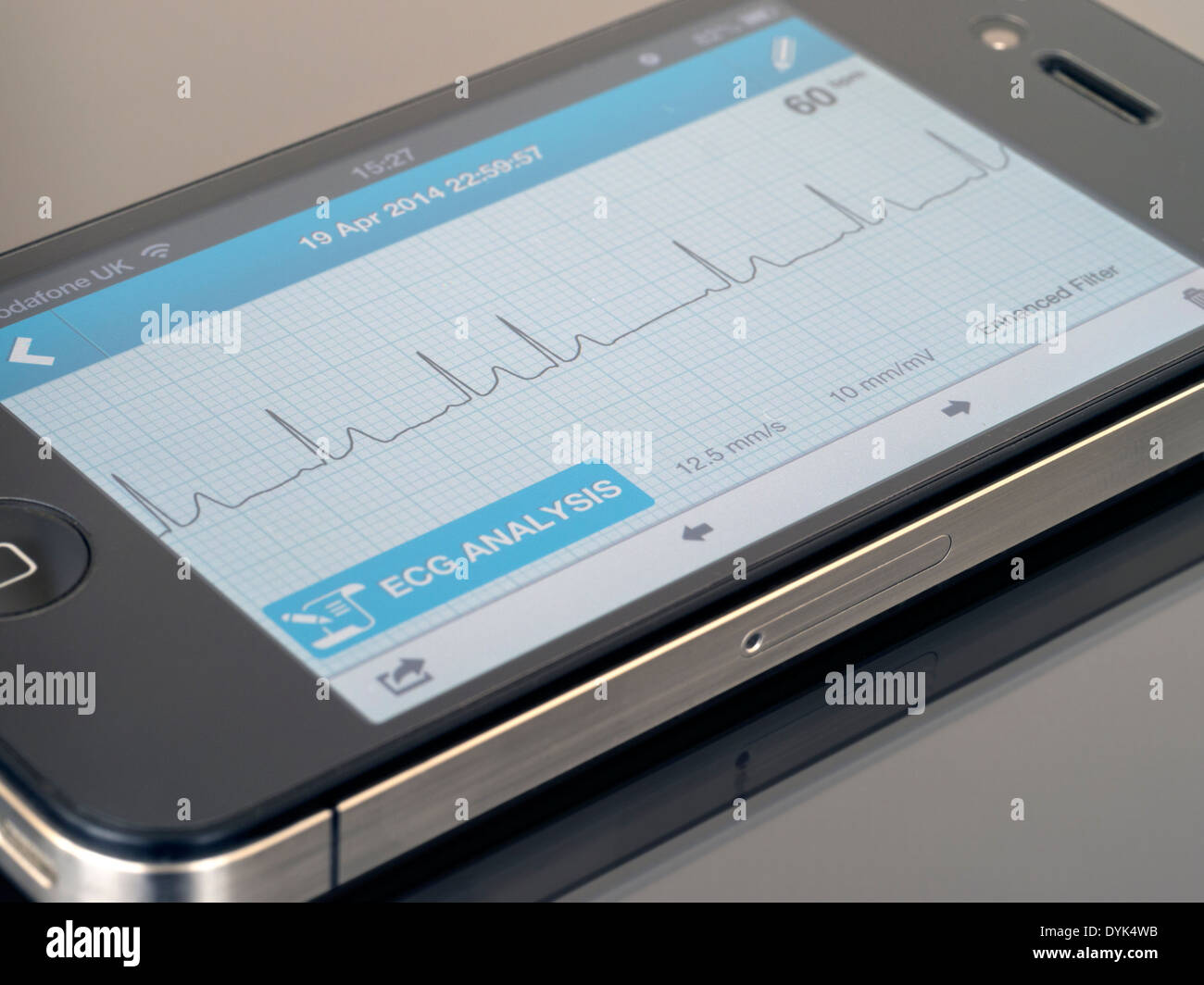 ECG portatile EKG Cardiofrequenzimetro App in esecuzione su iPhone 4 che mostra sinusale normale ritmo cardiaco tracciato con un battito ectopico. Foto Stock