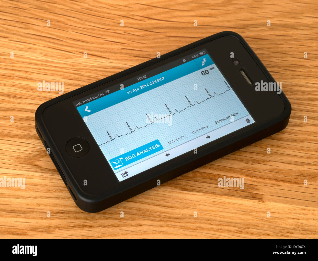 ECG portatile EKG cuore accessori monitor montati su iPhone 4 e che mostra un sinusale normale ritmo cardiaco traccia. Foto Stock