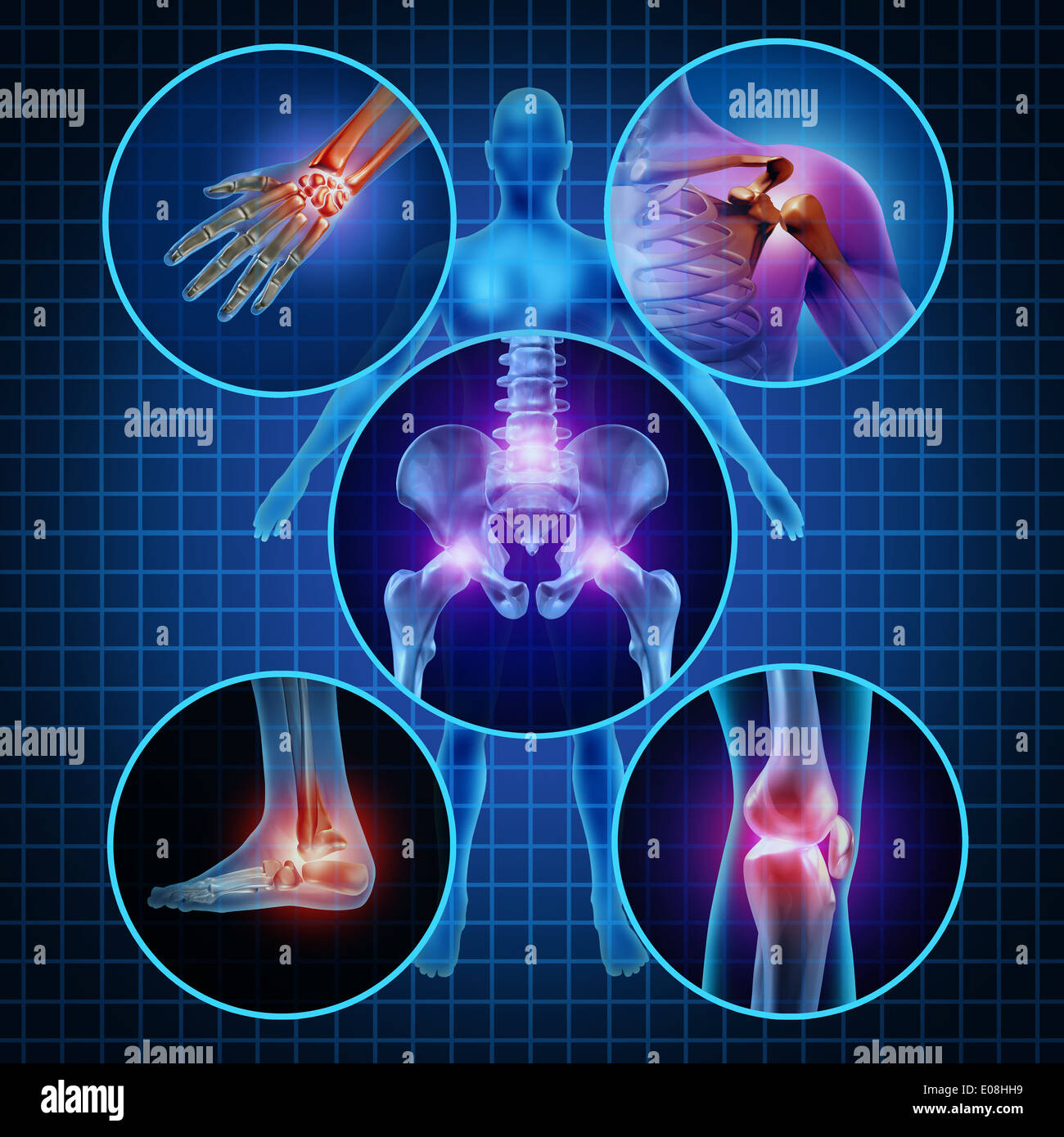 Giunti dolorosa anatomia umana concetto con il corpo come un gruppo di pannelli di forma circolare delle aree infiammate come il dolore e la lesione o malattia artrite simbolo per cure sanitarie e mediche i sintomi dovuti all'invecchiamento o sport e agli infortuni sul lavoro. Foto Stock