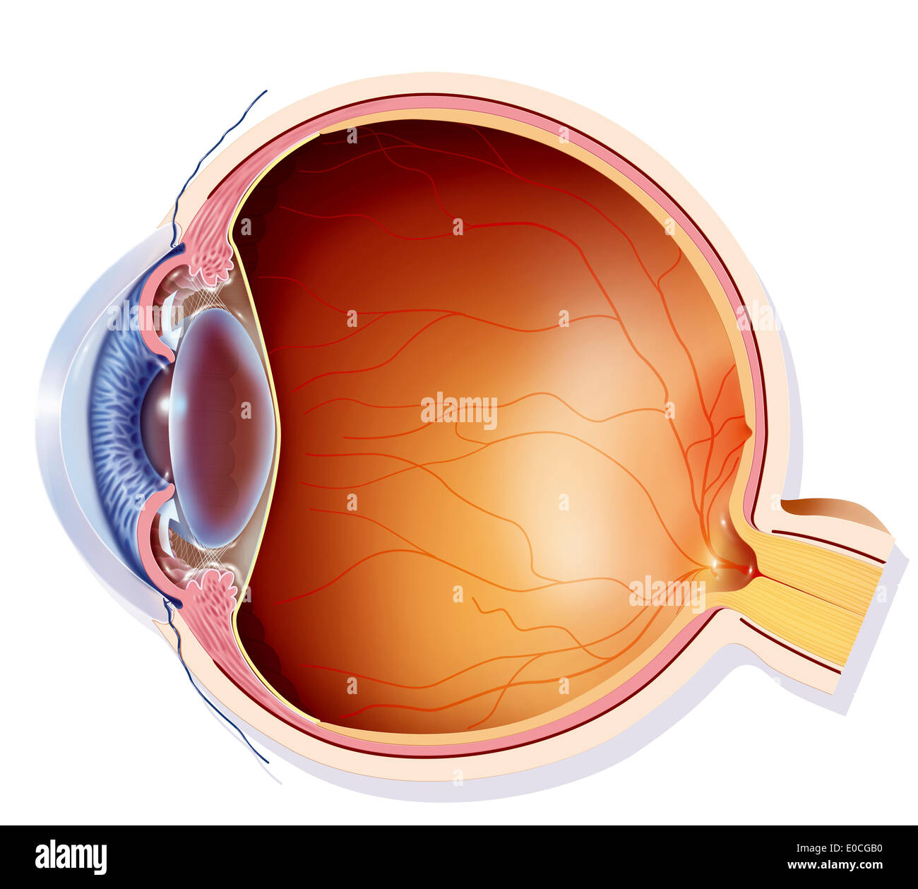 Il glaucoma, disegno Foto Stock