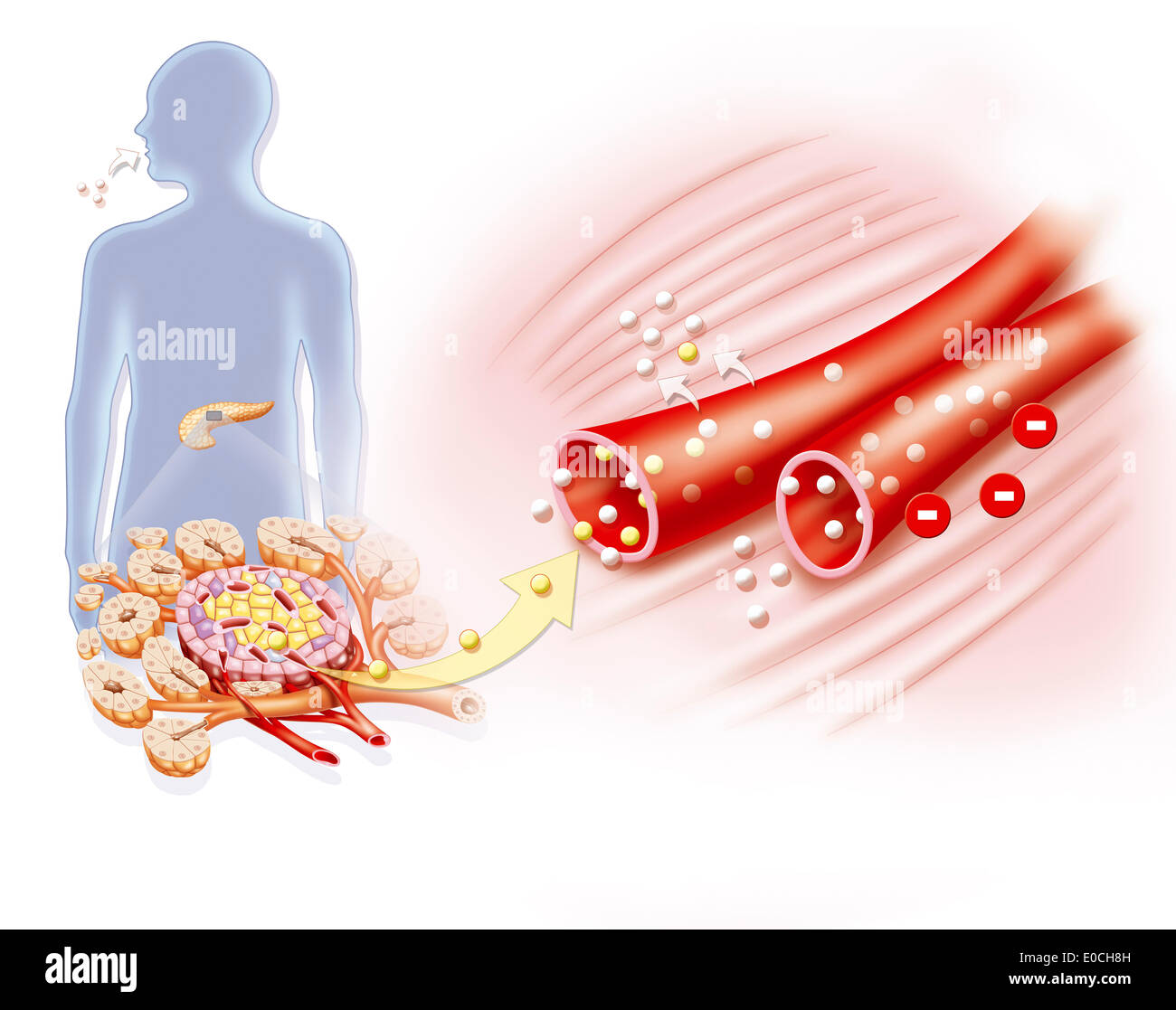 Il diabete, disegno Foto Stock