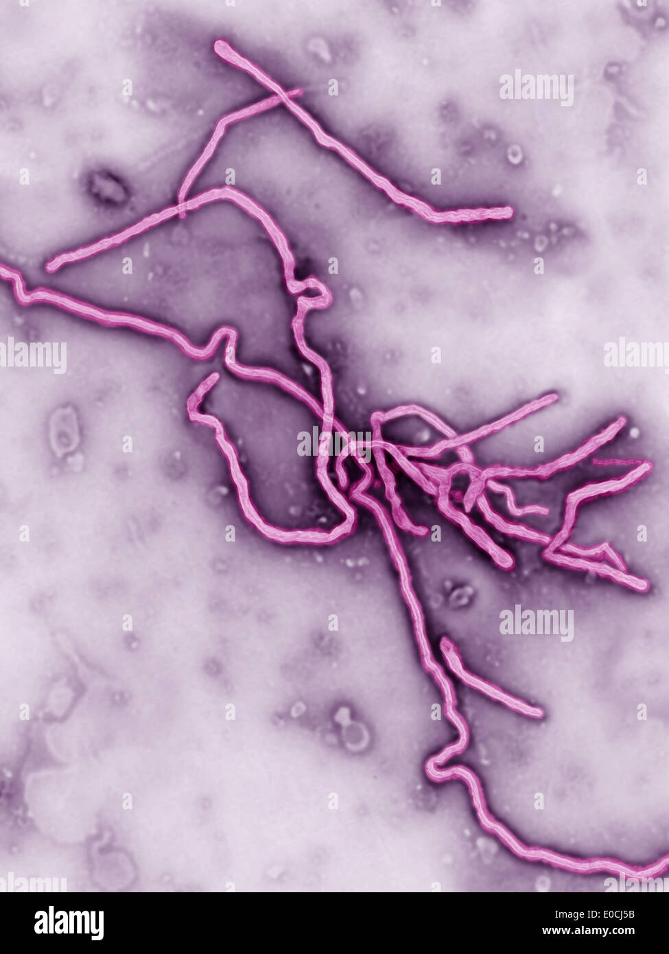 Virus Ebola Foto Stock